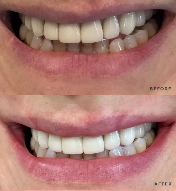 24719 smile lab pros cons
