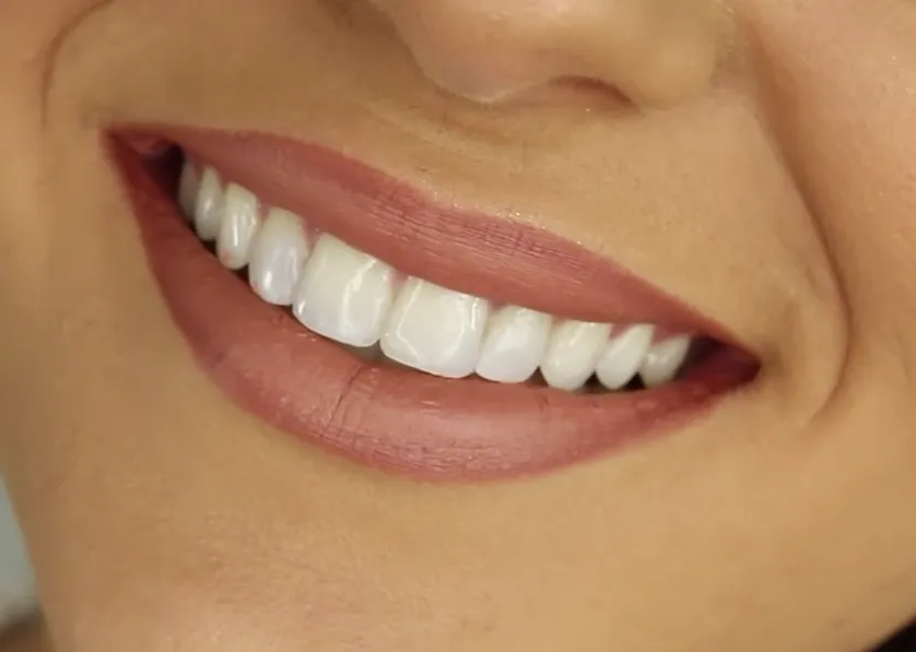 24724 gum irritation