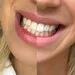 24725 healthy smile