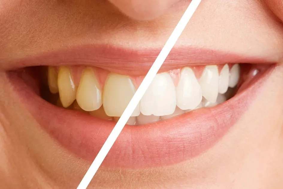 24728 dental procedure
