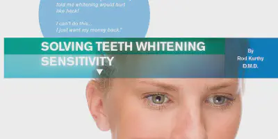 /img/24728-smile-makeover.webp
