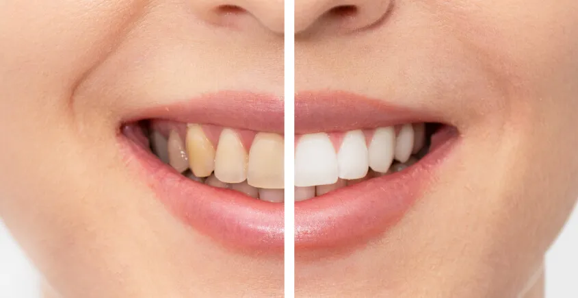 24729 katy tx teeth whitening products