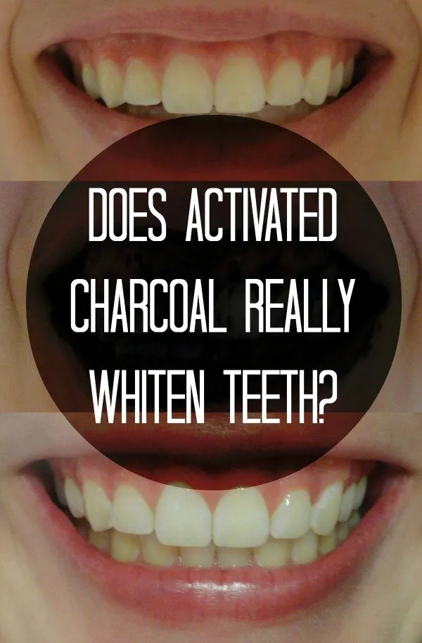 24734 gum irritation from charcoal