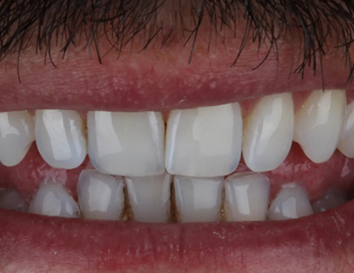 /img/24735-dentist-consultation.webp