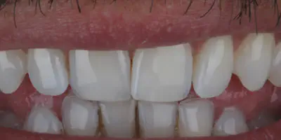 /img/24735-dentist-consultation.webp