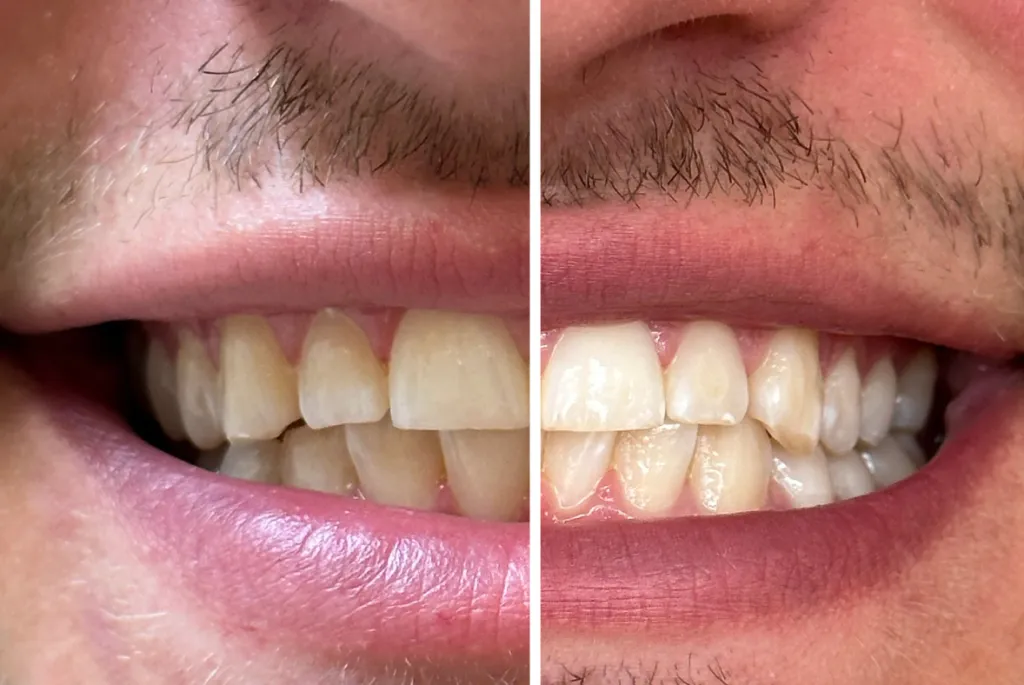 24737 avoid staining foods