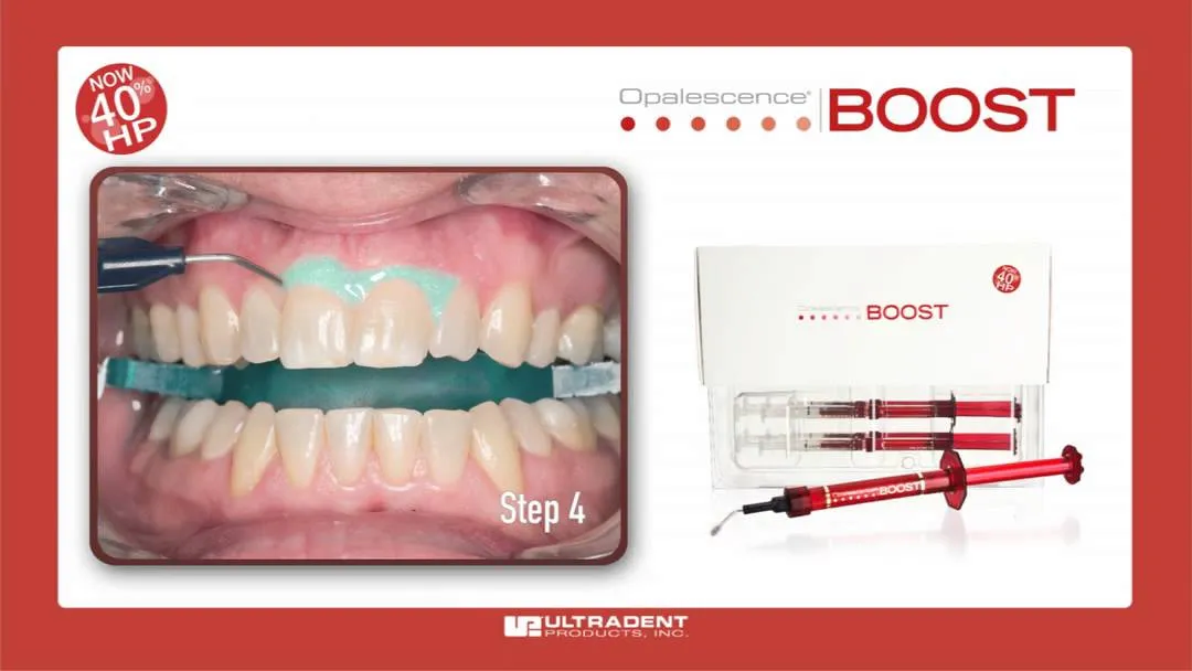 24737 professional teeth whitening
