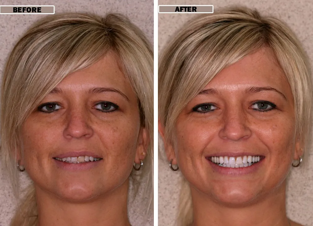 24738 avoid staining foods