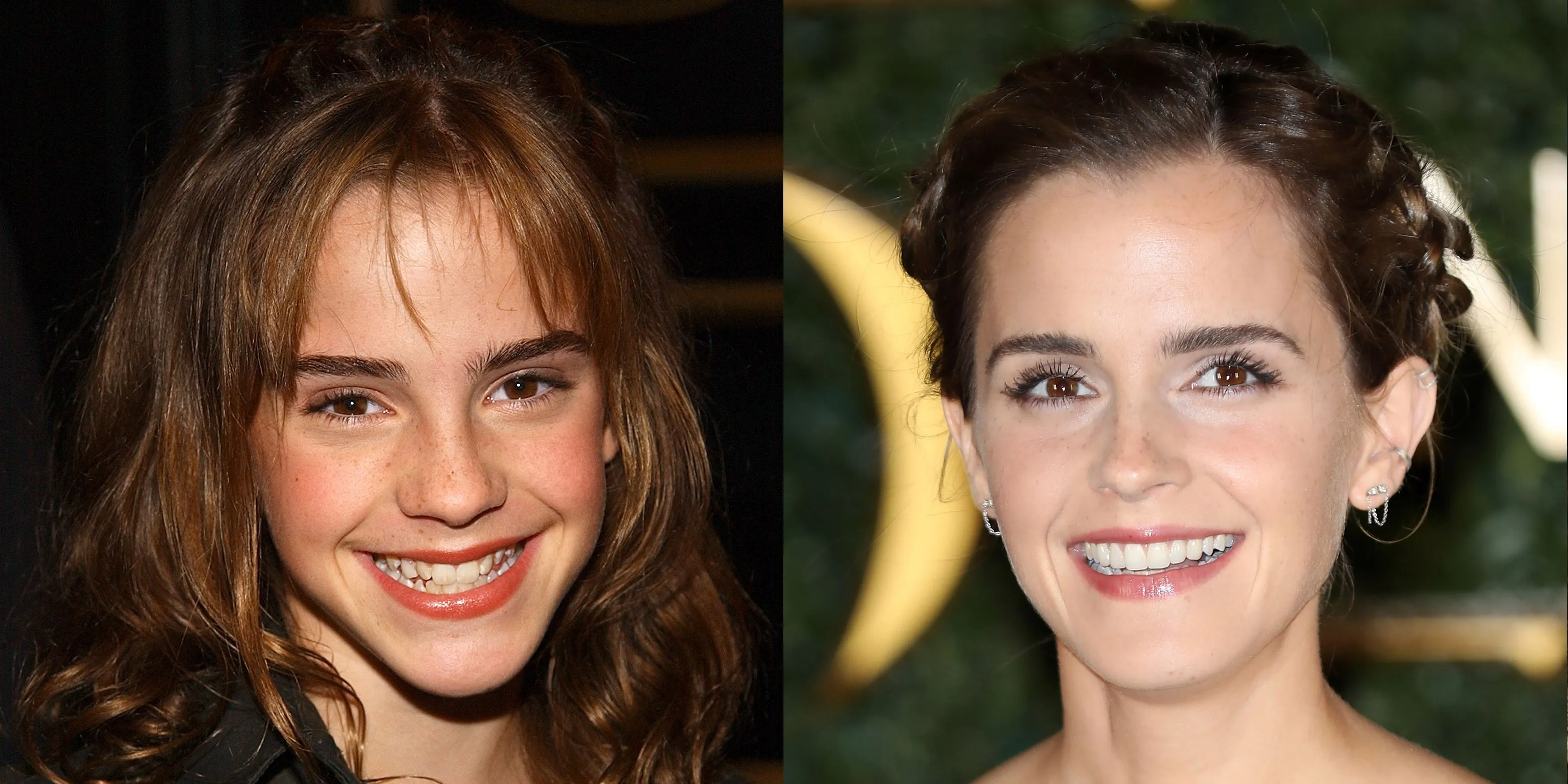 24742 at home teeth whitening