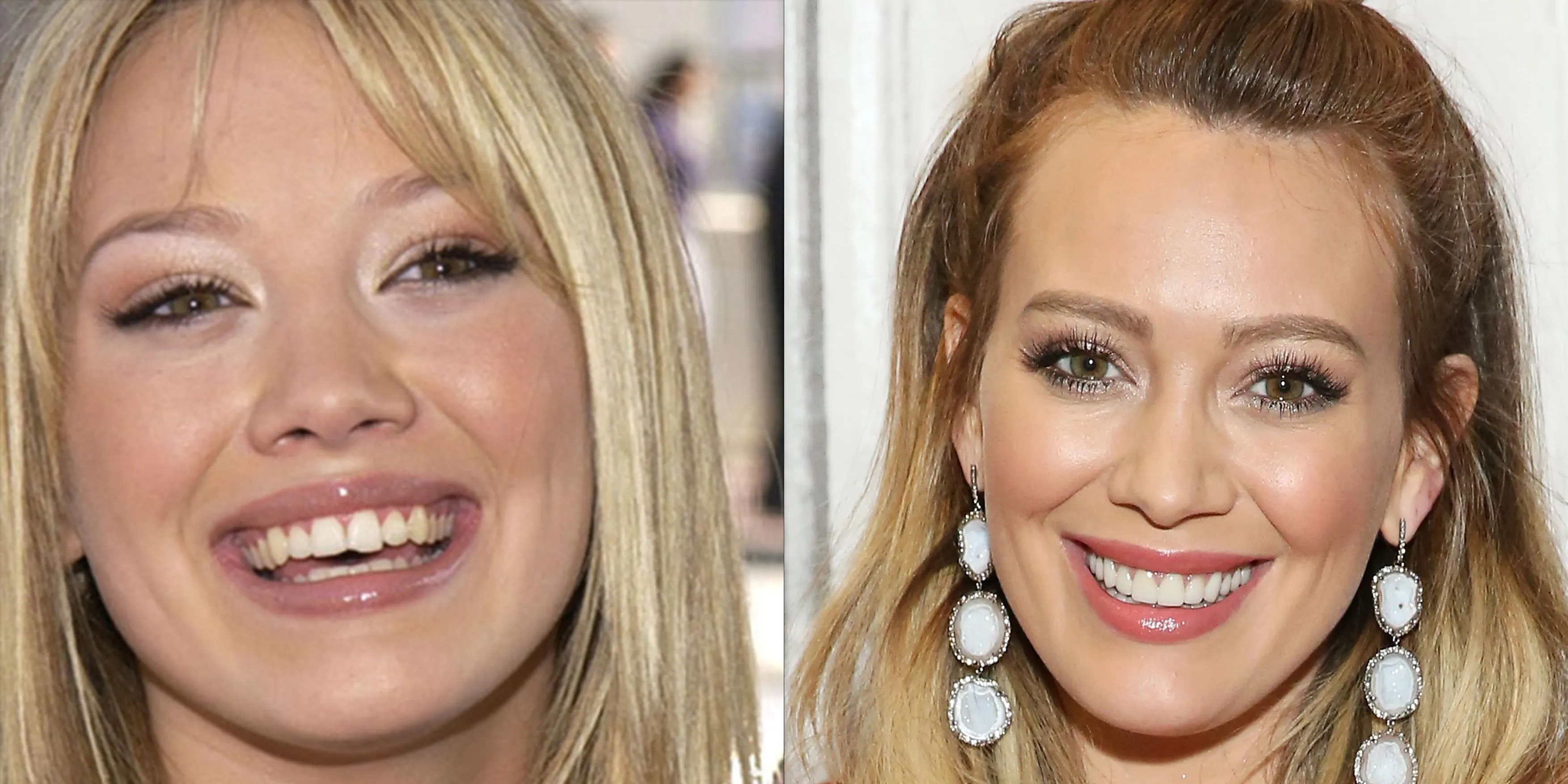 /img/24742-celebrity-teeth.webp