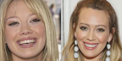 /img/24742-celebrity-teeth.webp