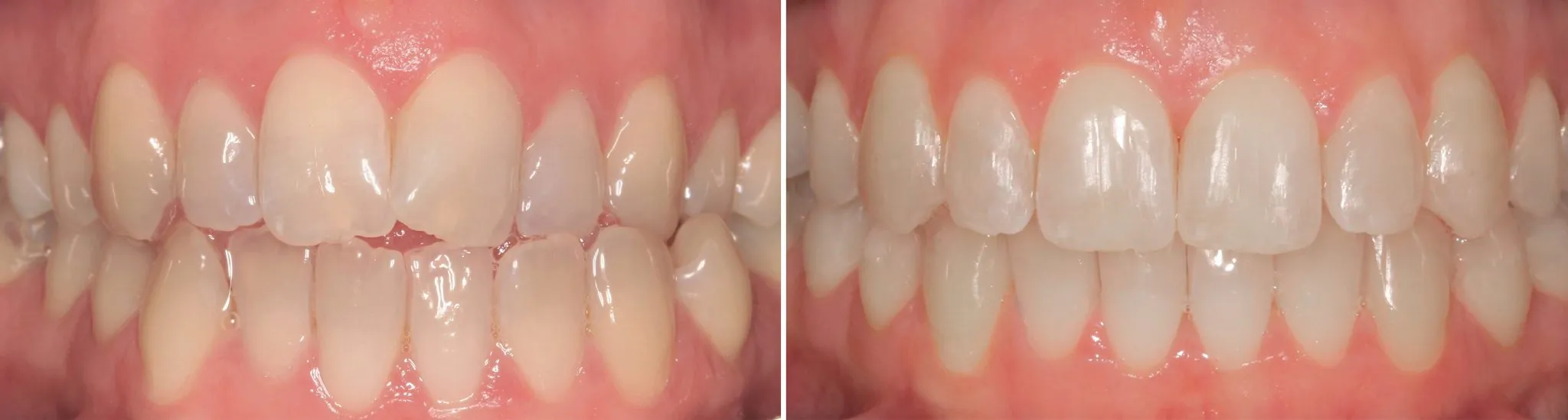 /img/24743-dentist-consultation.webp