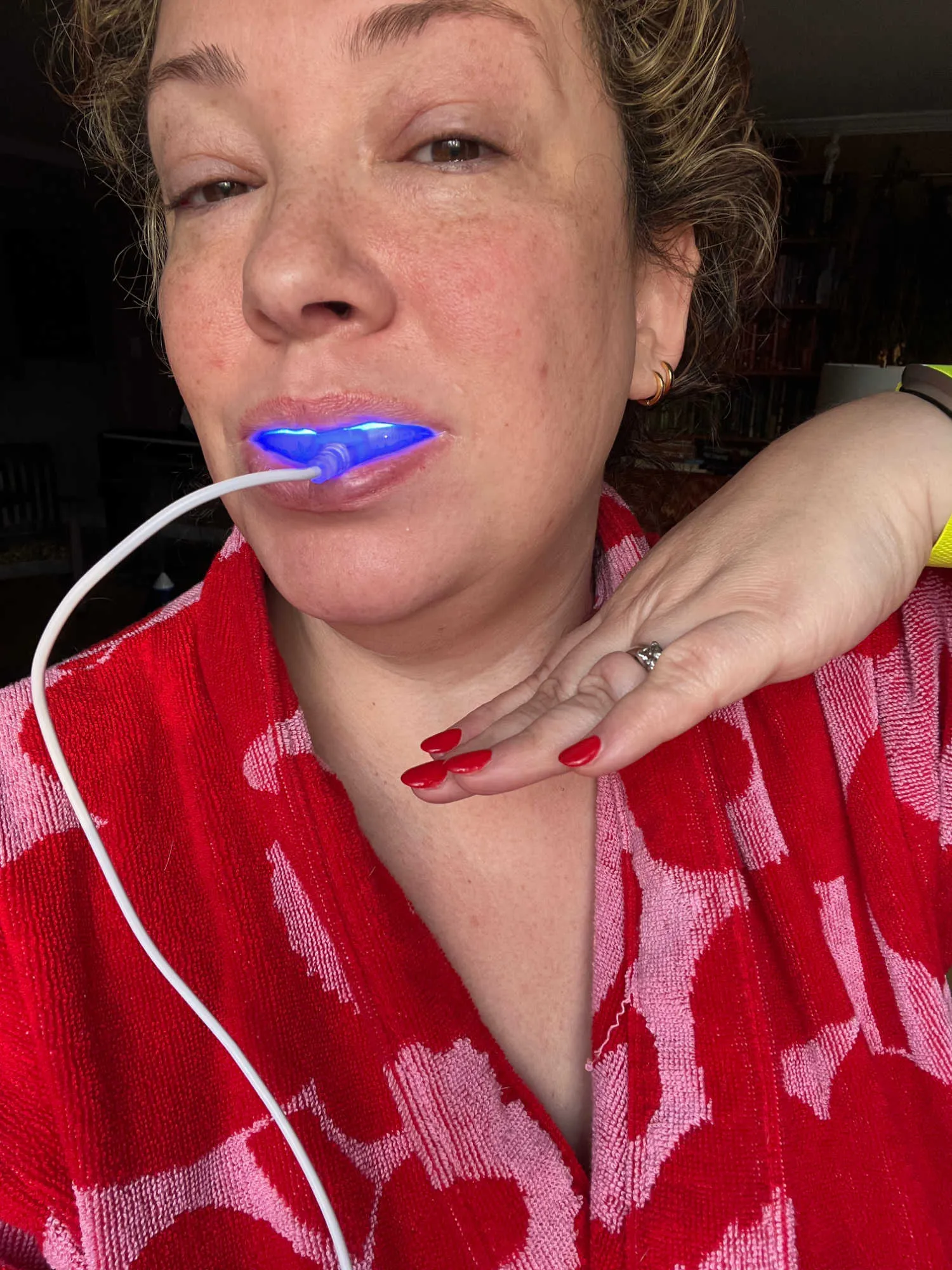 24744 gronk snow teeth whitening gentle whitening