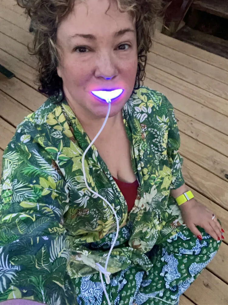 24744 gronk snow teeth whitening long lasting results