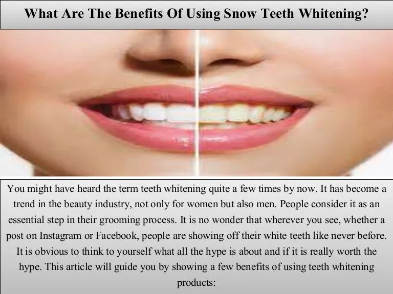 24744 gronk snow teeth whitening oral health