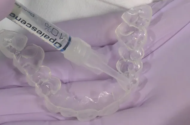 24746 teeth whitening tray