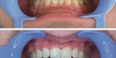 /img/24747-avoid-teeth-staining-foods.webp