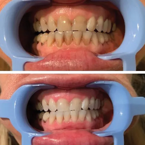 24747 provo dentist consultation