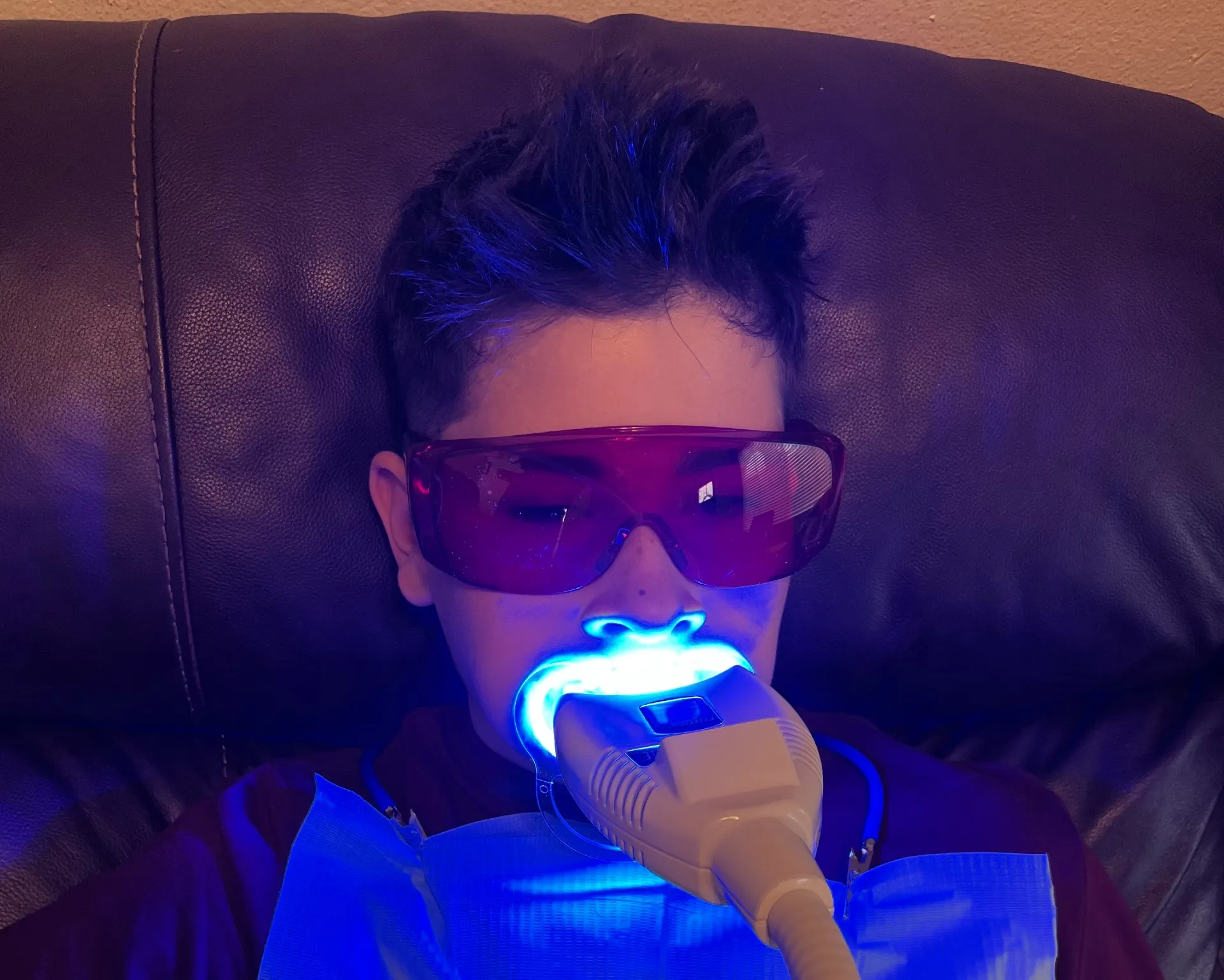 24747 teeth discoloration causes