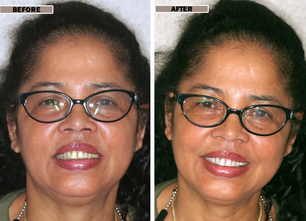 /img/24748-smile-lounge-teeth-whitening-appointment.webp