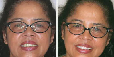 /img/24748-smile-lounge-teeth-whitening-appointment.webp