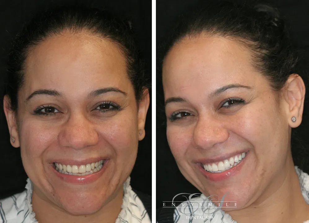24748 smile lounge teeth whitening smile
