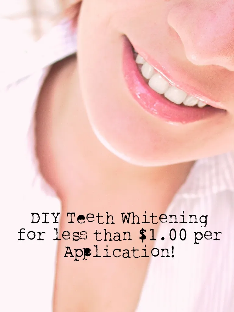 24750 teeth whitening 3