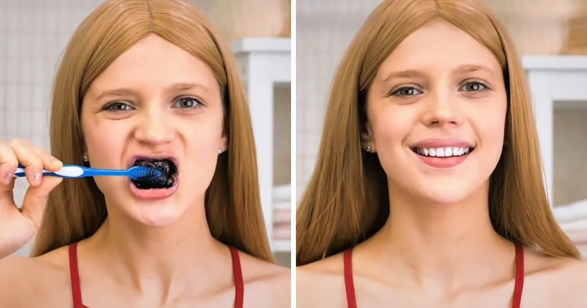 24750 teeth whitening 6