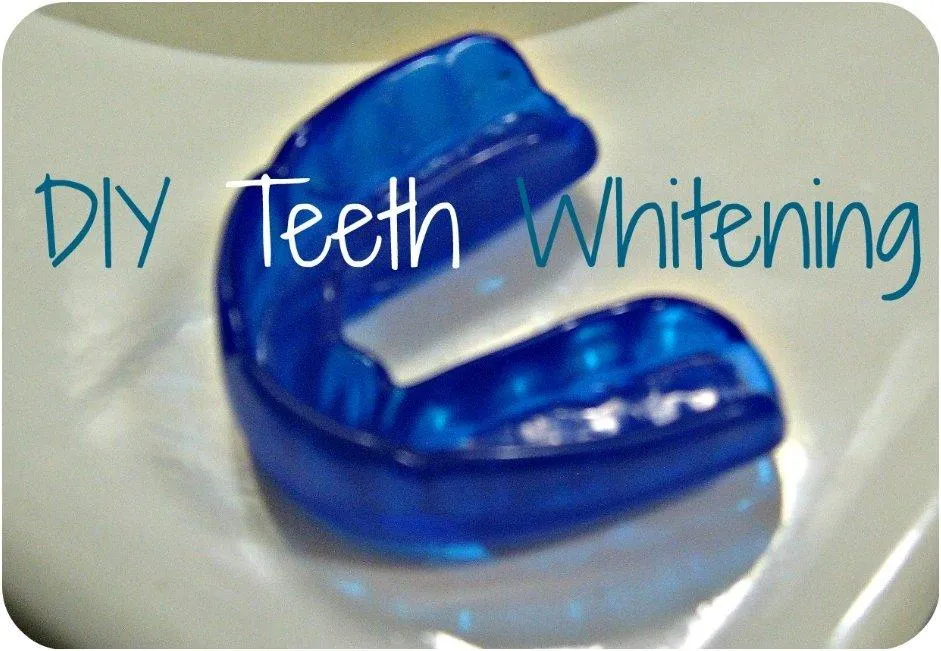 /img/24750-teeth-whitening-7.webp