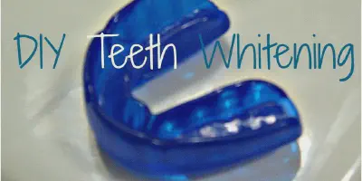 /img/24750-teeth-whitening-7.webp