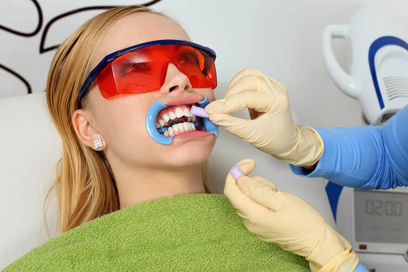 24751 professional teeth whitening