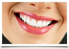 24751 teeth whitening before after