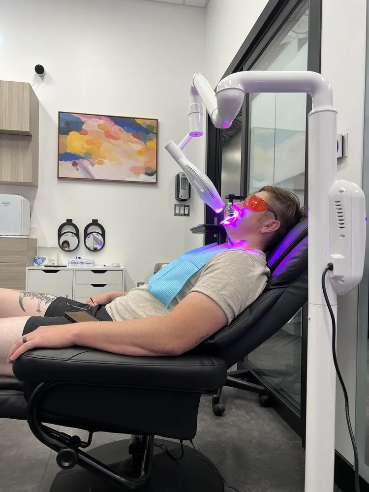 24752 teeth whitening before after