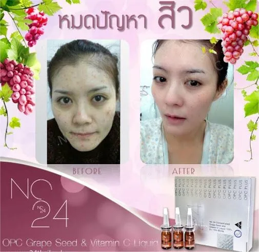 24755 whitening product brands