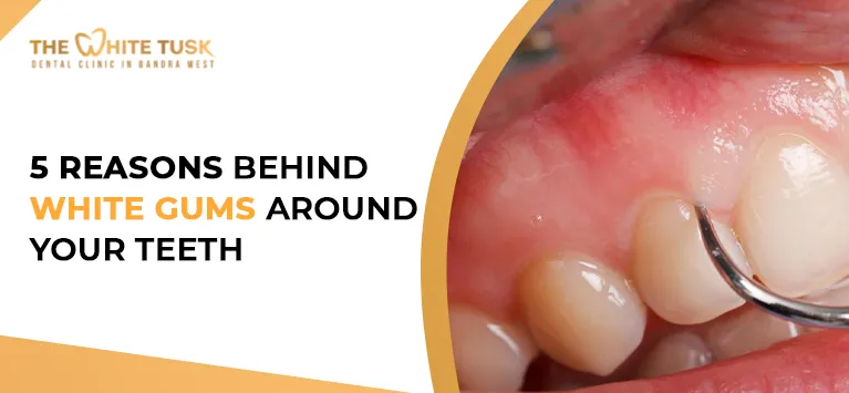 24759 dental checkup