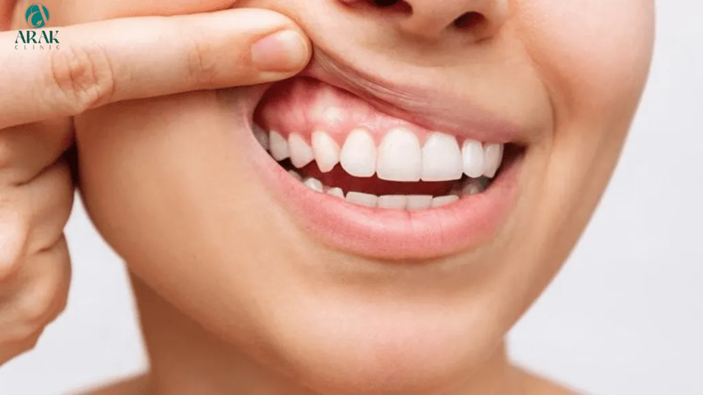 24759 healthy gums