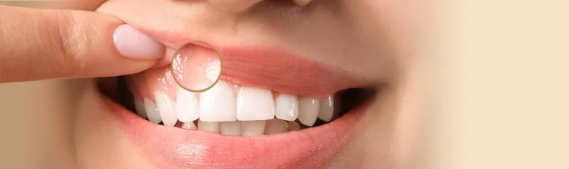24759 teeth whitening products