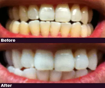 /img/24760-healthy-teeth-care.webp