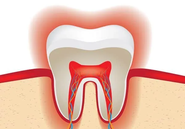24762 sensitive teeth after whitening 3