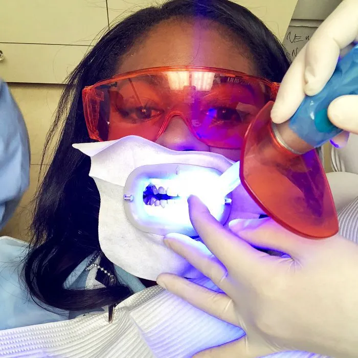 /img/24763-teeth-whitening-results.webp