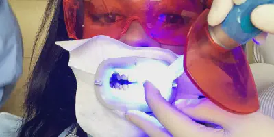 /img/24763-teeth-whitening-results.webp