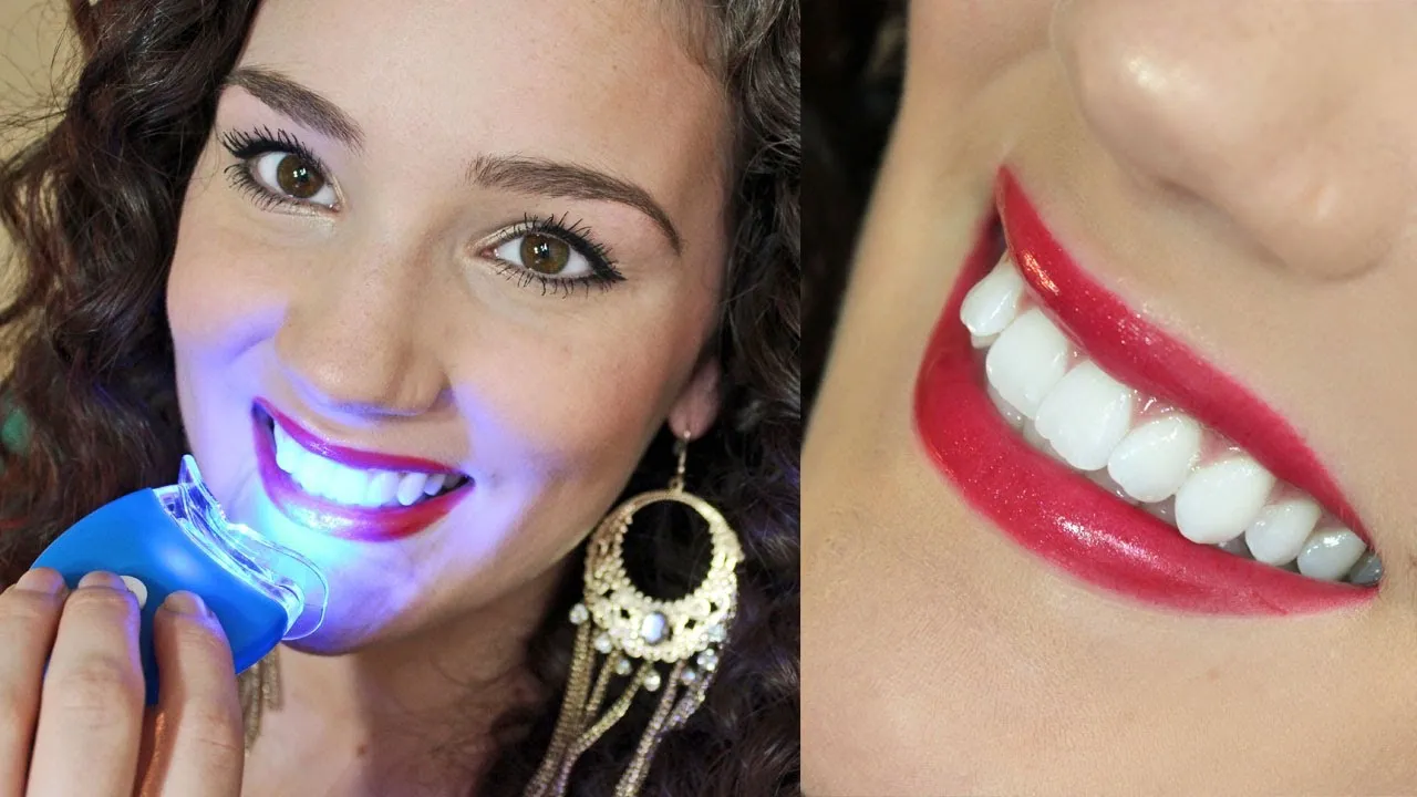 /img/24766-smiling-person-teeth.webp