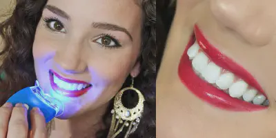 /img/24766-smiling-person-teeth.webp
