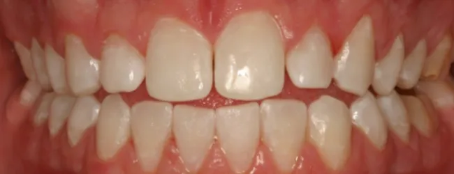 /img/24767-smile-with-teeth.webp