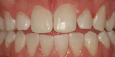 /img/24767-smile-with-teeth.webp