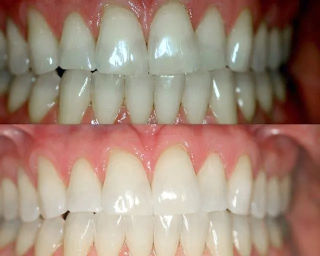 24771 dental problems caused by smoking