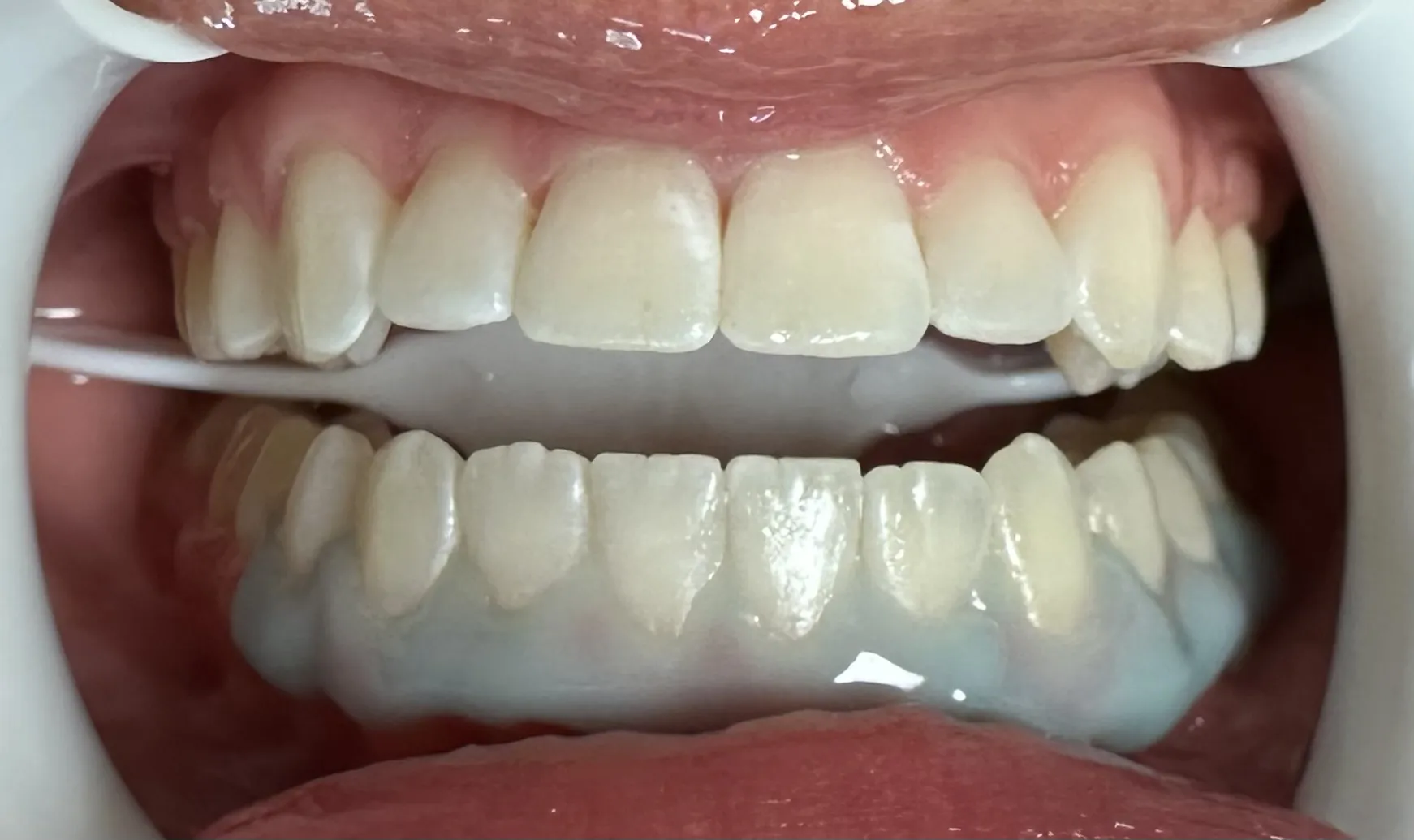 24775 healthy teeth diet