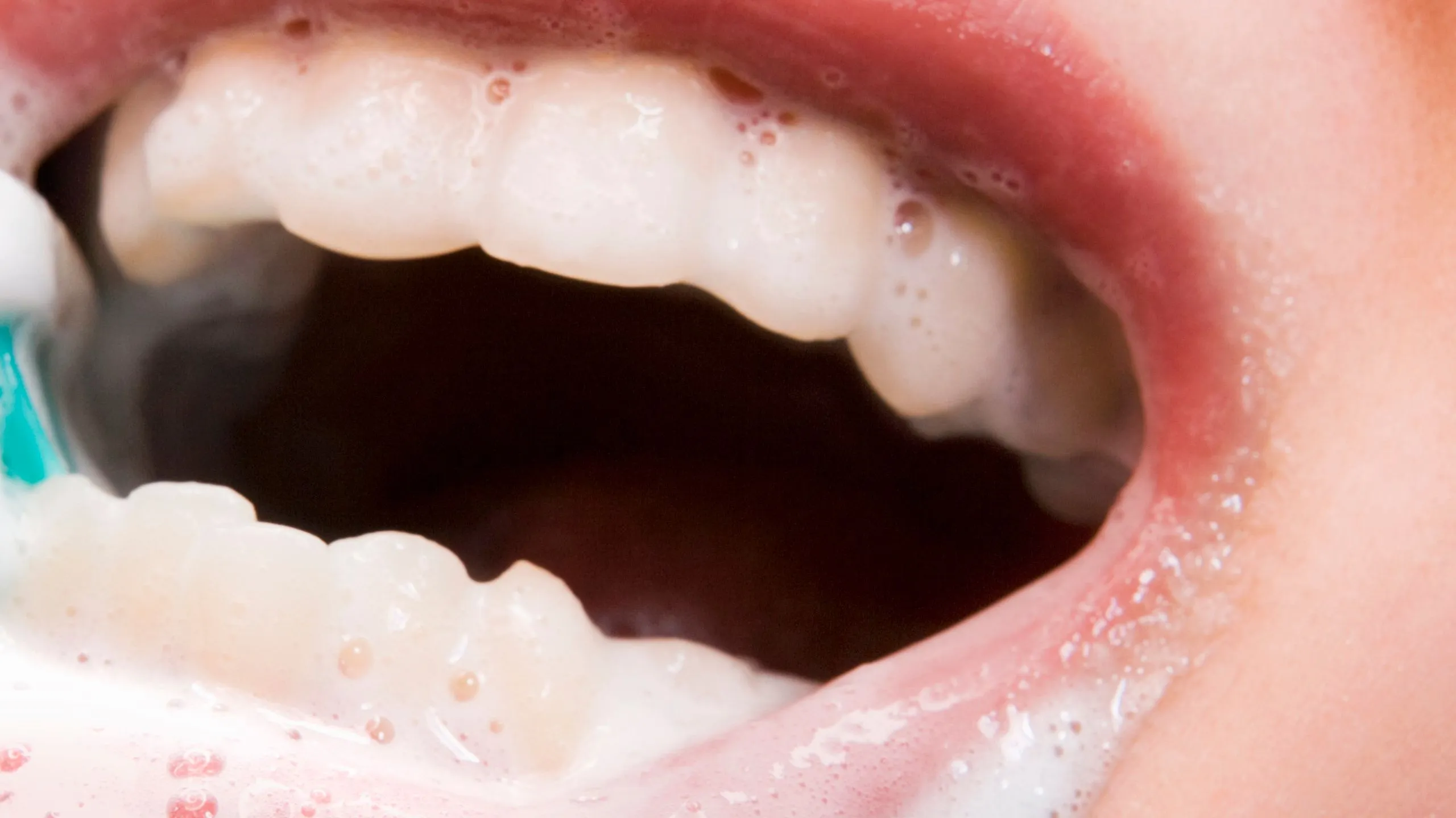 /img/24778-baking-soda-teeth-whitening-7.webp