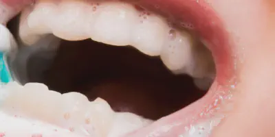 /img/24778-baking-soda-teeth-whitening-7.webp