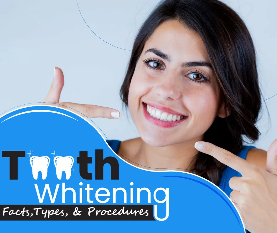 24780 teeth whitening side effects